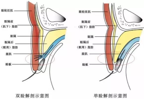 蒙古褶会消失吗_没有蒙古褶的中国人_没有蒙古褶是汉人吗